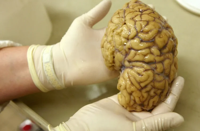 Atividade gênica no córtex pré-frontal é mapeada para tratar Alzheimer, Parkinson e esquizofrenia
