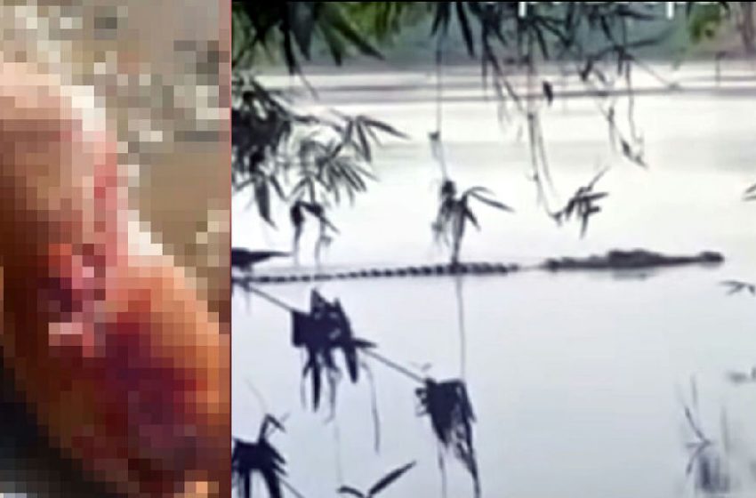  Pescador sofre ataque de jacaré e tem perna dilacerada em rio no Pará
