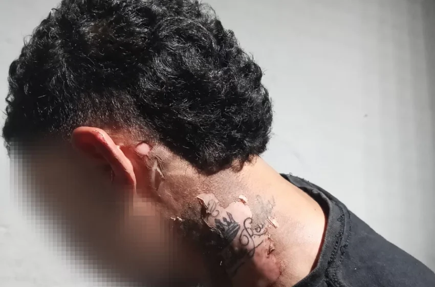 Agressão com óleo quente deixa homem ferido no bairro Altamira em Parauapebas