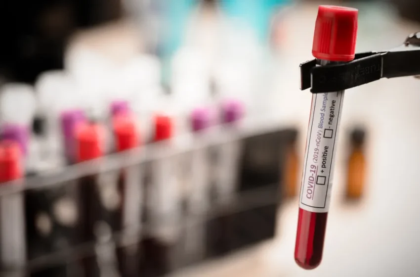Novo exame de sangue capaz de detectar 50 tipos de câncer chega ao Brasil